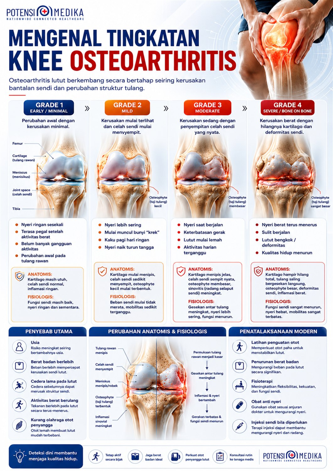 Poster edukasi osteoartritis lutut